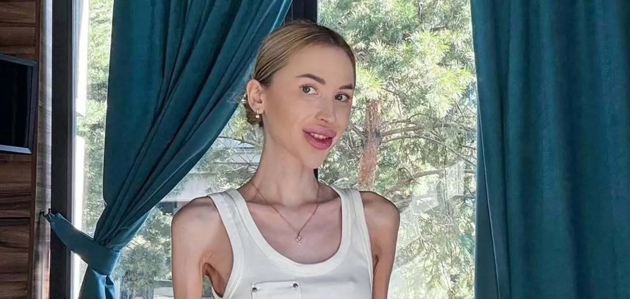 Аліна Ліпницька: що відомо про найхудішу блогерку України і як вона живе зараз